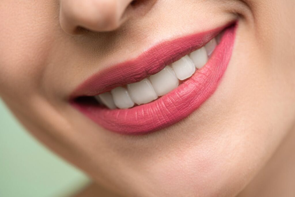 zoom teeth whitening doral