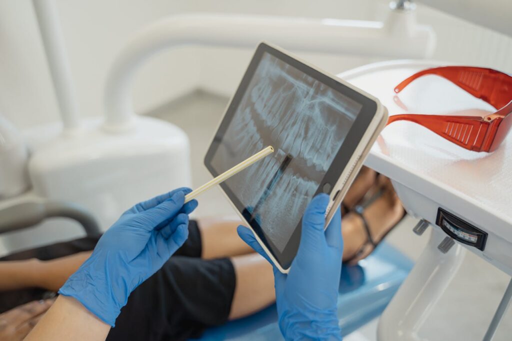 root canal doral