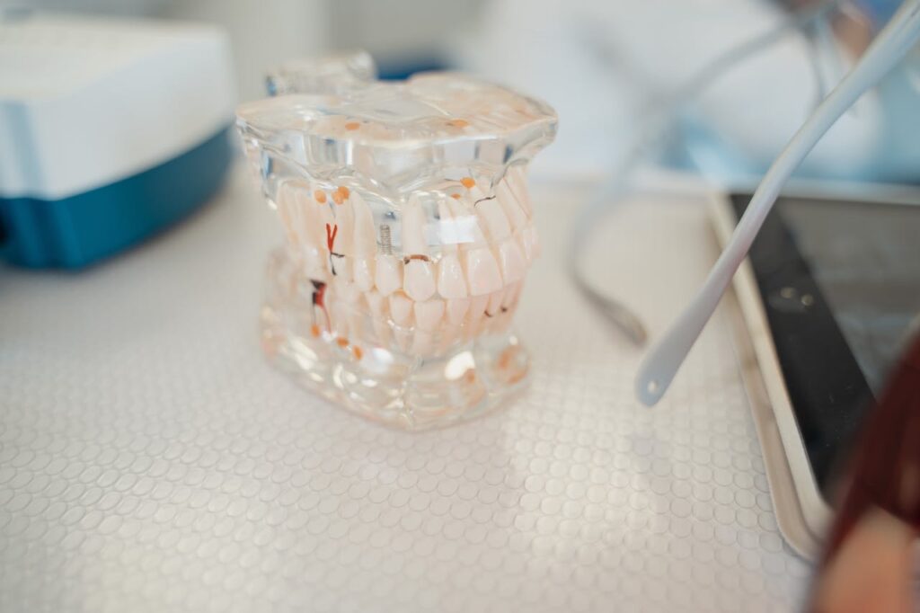 dental implants doral