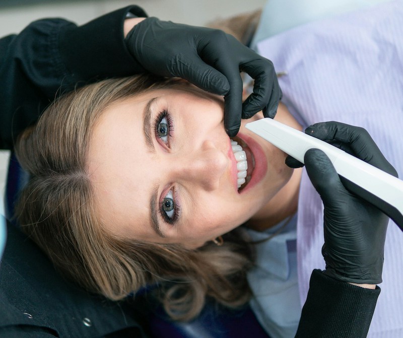 cosmetic fillings